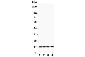Western blot testing of PDGF-B antibody and Lane 1:  rat heart (PDGFB 抗体  (AA 82-190))