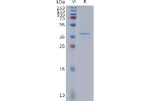 Human B13 Protein, Flag Tag on SDS-PAGE under reducing condition. (HSD17B13 Protein (AA 1-300) (DYKDDDDK Tag))