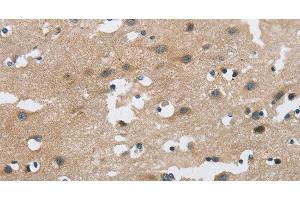 Immunohistochemistry of paraffin-embedded Human brain using FGF9 Polyclonal Antibody at dilution of 1:40 (FGF9 抗体)
