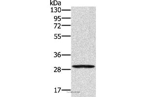 Western blot analysis of 293T cell, using EDA2R Polyclonal Antibody at dilution of 1:250 (Ectodysplasin A2 Receptor 抗体)