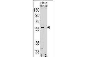 SMAD5 Antibody pre-incubated without(lane 1) and with(lane 2) blocking peptide in Hela cell line lysate. (SMAD5 抗体  (AA 241-269))