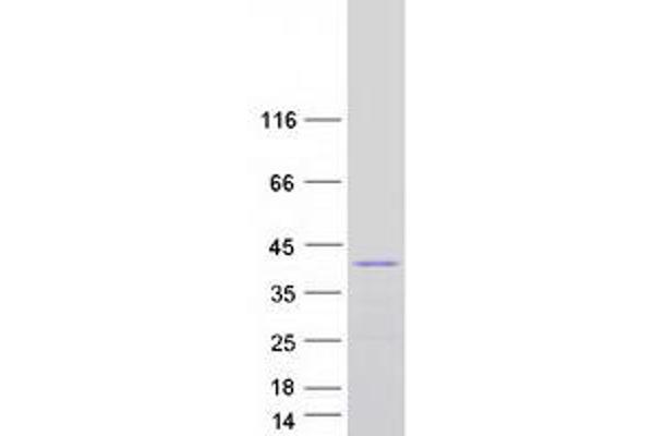 Lbx1 Protein (Myc-DYKDDDDK Tag)