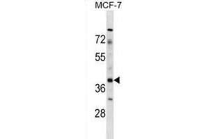 Western Blotting (WB) image for anti-Zygote Arrest 1 (ZAR1) antibody (ABIN2998776) (Zygote Arrest 1 抗体)