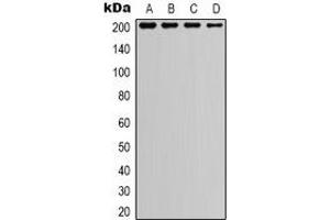 Western blot analysis of TSC2 expression in A549 (A), HEK293T (B), NIH3T3 (C), mouse kidney (D) whole cell lysates. (Tuberin 抗体)