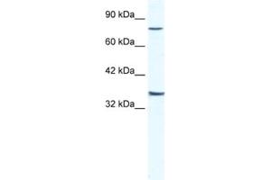 Western Blotting (WB) image for anti-Zinc Finger Protein 337 (ZNF337) antibody (ABIN2461596) (ZNF337 抗体)