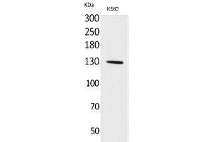 Western Blot analysis of K562 cells using Apaf-1 Polyclonal Antibody. (APAF1 抗体  (Internal Region))