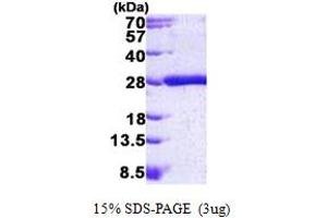 K-RAS Protein (AA 1-186) (His tag)