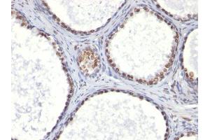 Image no. 1 for anti-Integrin Alpha2b (CD41) antibody (ABIN6156530) (Integrin Alpha2b 抗体)
