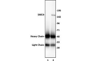 SMC4 antibody (pAb) tested by Immunoprecipitation. (SMC4 抗体  (N-Term))