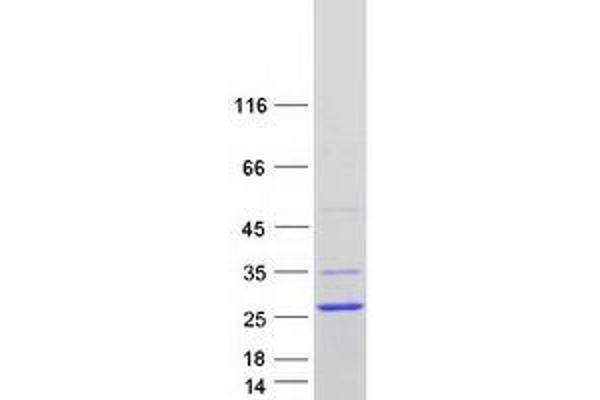 NHLH2 Protein (Transcript Variant 2) (Myc-DYKDDDDK Tag)