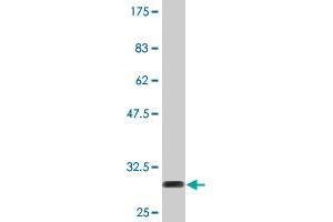 Western Blot detection against Immunogen (30. (Thymosin beta 10 抗体  (AA 1-44))