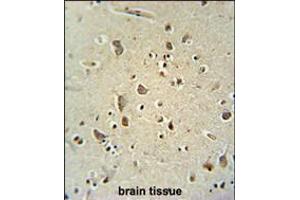 ATPGD1 antibody immunohistochemistry analysis in formalin fixed and paraffin embedded human brain tissue followed by peroxidase conjugation of the secondary antibody and DAB staining. (CARNS1 抗体  (N-Term))