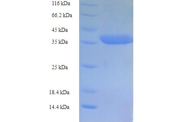 CASP5 Protein (AA 137-327, partial) (His-SUMO Tag)