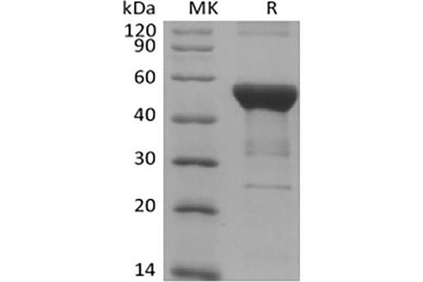 NFKB1 Protein (His tag)