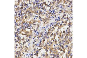 Immunohistochemistry (IHC) image for anti-Ribosomal Protein L5 (RPL5) antibody (ABIN1874650) (RPL5 抗体)