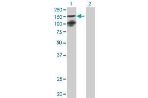 Lane 1: MTMR3 transfected lysate ( 131. (MTMR3 293T Cell Transient Overexpression Lysate(Denatured))