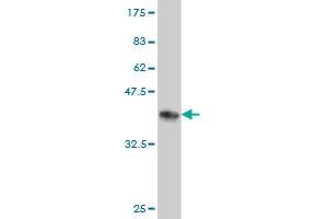 Western Blotting (WB) image for anti-Ribonucleotide Reductase M2 (RRM2) (AA 1-110) antibody (ABIN562744)