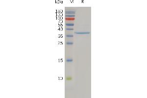 Human C Protein, hFc Tag on SDS-PAGE under reducing condition. (Claudin 3 Protein (CLDN3) (AA 30-80) (Fc Tag))