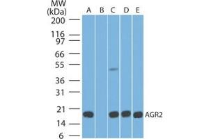 Image no. 1 for anti-Anterior Gradient Homolog 2 (Xenopus Laevis) (AGR2) (AA 50-100) antibody (ABIN1491565) (AGR2 抗体  (AA 50-100))