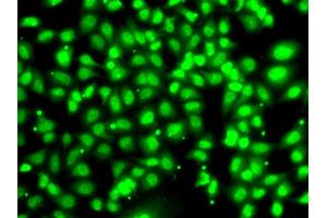Immunofluorescence analysis of U2OS cells using COPS2 antibody. (COPS2 抗体)