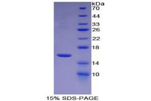 SDS-PAGE analysis of Mouse Coagulation Factor VII Protein. (Factor VII 蛋白)