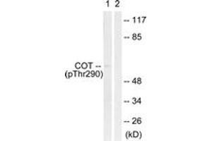 Western blot analysis of extracts from 293 cells treated with UV 15', using COT (Phospho-Thr290) Antibody. (CROT 抗体  (pThr290))