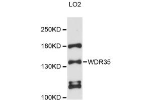 Western blot analysis of extracts of LO2 cells, using WDR35 antibody (ABIN6293806) at 1:3000 dilution. (WDR35 抗体)