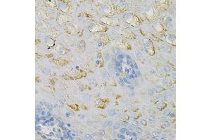 Immunohistochemistry of paraffin-embedded human esophagus using COX4I1 Antibody (ABIN2561975) at dilution of 1:100 (40x lens). (COX IV 抗体)