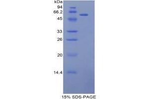 SDS-PAGE analysis of Mouse L1CAM Protein. (L1CAM 蛋白)