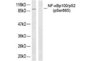 Western blot analysis of extracts from ovary cancer, using NF-kappaB p100/p52 (Phospho-Ser865) Antibody. (NFKB2 抗体  (pSer866))