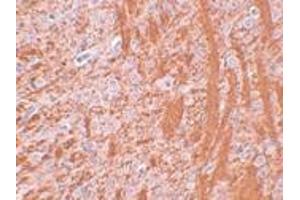 Immunohistochemistry (IHC) image for anti-Jumonji Domain Containing 6 (JMJD6) (N-Term) antibody (ABIN1031427) (JMJD6 抗体  (N-Term))