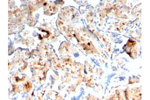 Immunohistochemistry (IHC) image for anti-S100 Calcium Binding Protein A4 (S100A4) (AA 1-200) antibody (ABIN6940544)