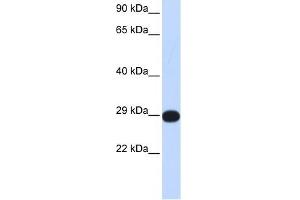 PPP4C antibody used at 1 ug/ml to detect target protein. (PPP4C 抗体)