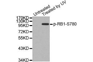 Western Blotting (WB) image for anti-Retinoblastoma 1 (RB1) (pSer780) antibody (ABIN1870571) (Retinoblastoma 1 抗体  (pSer780))