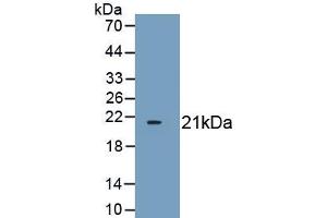 Detection of Recombinant CDKN1A, Mouse using Polyclonal Antibody to Cyclin Dependent Kinase Inhibitor 1A (CDKN1A) (p21 抗体  (AA 2-159))