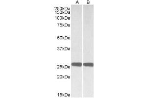 Western Blotting (WB) image for anti-Ubiquitin Carboxyl-terminal Esterase L1 (Ubiquitin Thiolesterase) (UCHL1) (AA 58-68) antibody (ABIN5882512) (UCHL1 抗体  (AA 58-68))