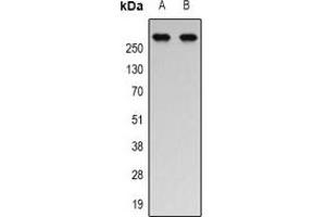 Western blot analysis of p300 (AcK1558/K1560) expression in Jurkat (A), HEK293T (B) whole cell lysates. (p300 抗体  (acLys1558, acLys1560))
