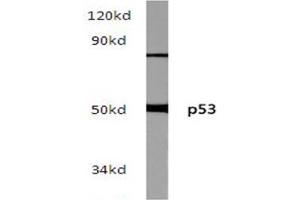 Western blot (WB) analysis of p53 pAb in extracts from hela cells. (p53 抗体)