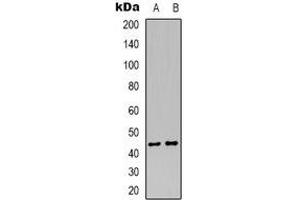 Western blot analysis of MKK4 expression in Hela (A), HEK293T (B) whole cell lysates. (MAP2K4 抗体  (C-Term))