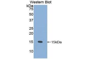 Western blot analysis of the recombinant protein. (PSCA 抗体  (AA 22-95))