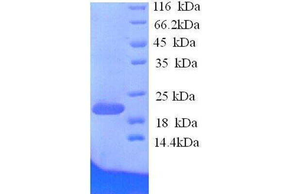 Ephrin A1 Protein (EFNA1) (AA 18-182, full length) (His tag)