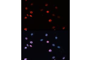 Immunofluorescence analysis of HeLa cells using DNMT3B Rabbit pAb (ABIN3016943, ABIN3016944, ABIN3016945 and ABIN6219896) at dilution of 100 (40x lens). (DNMT3B 抗体)