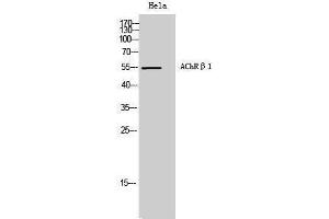 Western Blotting (WB) image for anti-AChR beta 1 (N-Term) antibody (ABIN3180474) (AChR beta 1 (N-Term) 抗体)