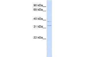 KCNRG antibody used at 1 ug/ml to detect target protein. (KCNRG 抗体  (N-Term))