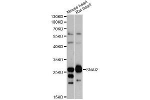 Western blot analysis of extracts of various cell lines, using SNAI2 antibody (ABIN5970416) at 1/1000 dilution. (SLUG 抗体)