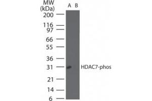 Image no. 1 for anti-Histone Deacetylase 7 (HDAC7) (pSer155) antibody (ABIN225621) (HDAC7 抗体  (pSer155))