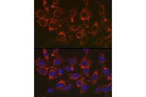 Immunofluorescence analysis of NIH/3T3 cells using Fibronectin Rabbit mAb (ABIN6133698, ABIN6135676, ABIN6135677 and ABIN7101415) at dilution of 1:50 (40x lens). (Fibronectin 1 抗体)