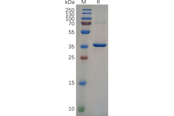 NEFL Protein (AA 89-400) (His tag)