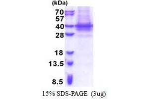 PIH1D1 Protein (AA 1-290) (His tag)