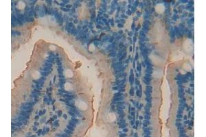 DAB staining on IHC-P; Samples: Mouse Intestine Tissue (ACP5 抗体  (AA 28-286))